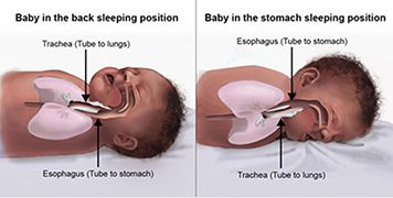 Should a newborn sleep on their side sale